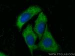Alpha-2-antiplasmin Antibody in Immunocytochemistry (ICC/IF)
