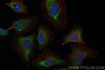 WIPI2 Antibody in Immunocytochemistry (ICC/IF)