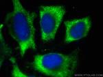 ULK1 Antibody in Immunocytochemistry (ICC/IF)