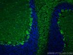 Parvalbumin Antibody in Immunohistochemistry (PFA fixed) (IHC (PFA))