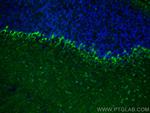 Parvalbumin Antibody in Immunohistochemistry (PFA fixed) (IHC (PFA))