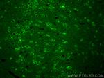 DCLK1 Antibody in Immunohistochemistry (PFA fixed) (IHC (PFA))