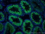 LRRC50 Antibody in Immunohistochemistry (PFA fixed) (IHC (PFA))