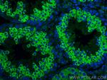 LRRC50 Antibody in Immunohistochemistry (PFA fixed) (IHC (PFA))