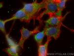 WNT8A Antibody in Immunocytochemistry (ICC/IF)