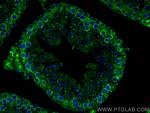 DDX4, VASA Antibody in Immunohistochemistry (PFA fixed) (IHC (PFA))