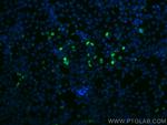 HA tag Antibody in Immunocytochemistry (ICC/IF)