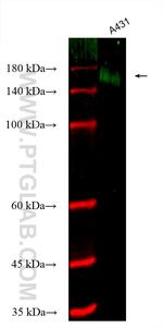 EGFR Antibody in Western Blot (WB)