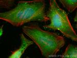 Cyclin B1 Antibody in Immunocytochemistry (ICC/IF)