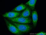 MTCO2 Antibody in Immunocytochemistry (ICC/IF)