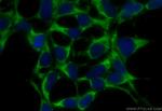 SH2D5 Antibody in Immunocytochemistry (ICC/IF)