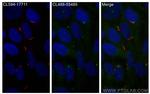 Rootletin Antibody in Immunocytochemistry (ICC/IF)
