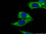 Transgelin 2 Antibody in Immunocytochemistry (ICC/IF)