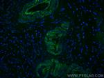 Transgelin 2 Antibody in Immunohistochemistry (PFA fixed) (IHC (PFA))