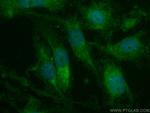 MGP Antibody in Immunocytochemistry (ICC/IF)