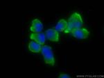 GMF Beta Antibody in Immunocytochemistry (ICC/IF)