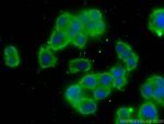 Chromogranin A Antibody in Immunocytochemistry (ICC/IF)