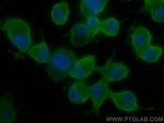Chromogranin A Antibody in Immunocytochemistry (ICC/IF)