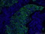 CD206 Antibody in Immunohistochemistry (PFA fixed) (IHC (PFA))