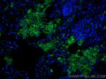 CD206 Antibody in Immunohistochemistry (PFA fixed) (IHC (PFA))