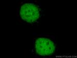 PAX8 Antibody in Immunocytochemistry (ICC/IF)
