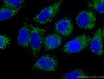 GSTO1 Antibody in Immunocytochemistry (ICC/IF)