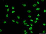 FUS/TLS Antibody in Immunocytochemistry (ICC/IF)