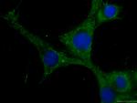 CKM-Specific Antibody in Immunocytochemistry (ICC/IF)