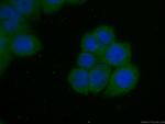 BCL2 Antibody in Immunocytochemistry (ICC/IF)