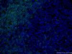 CD3 Antibody in Immunohistochemistry (PFA fixed) (IHC (PFA))