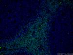 CD3 Antibody in Immunohistochemistry (PFA fixed) (IHC (PFA))