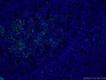CD23 Antibody in Immunohistochemistry (PFA fixed) (IHC (PFA))
