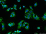 CXCR7 Antibody in Immunocytochemistry (ICC/IF)