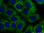 FUT9 Antibody in Immunocytochemistry (ICC/IF)