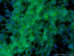 NCAM1/CD56 Antibody in Immunocytochemistry (ICC/IF)