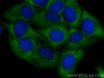 CCT3 Antibody in Immunocytochemistry (ICC/IF)