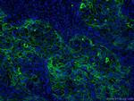 ICAM-1 Antibody in Immunohistochemistry (PFA fixed) (IHC (PFA))