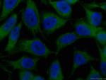 VCP Antibody in Immunocytochemistry (ICC/IF)