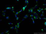 CD107a/LAMP1 Antibody in Immunocytochemistry (ICC/IF)