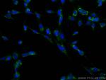 CD107b/LAMP2 Antibody in Immunocytochemistry (ICC/IF)