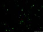 CD38 Antibody in Immunocytochemistry (ICC/IF)