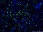 HA Tag Antibody in Immunocytochemistry (ICC/IF)