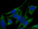 EIF3D Antibody in Immunocytochemistry (ICC/IF)