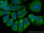 EIF3M Antibody in Immunocytochemistry (ICC/IF)