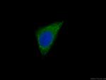 CAPZA1 Antibody in Immunocytochemistry (ICC/IF)