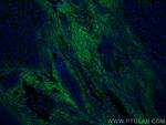 Serum amyloid P component Antibody in Immunohistochemistry (PFA fixed) (IHC (PFA))