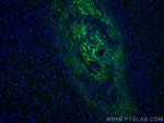 Serum amyloid P component Antibody in Immunohistochemistry (PFA fixed) (IHC (PFA))