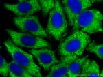 S100A6 Antibody in Immunocytochemistry (ICC/IF)