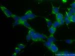 S100A6 Antibody in Immunocytochemistry (ICC/IF)