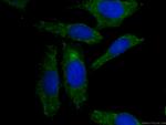 APOL1-Specific Antibody in Immunocytochemistry (ICC/IF)